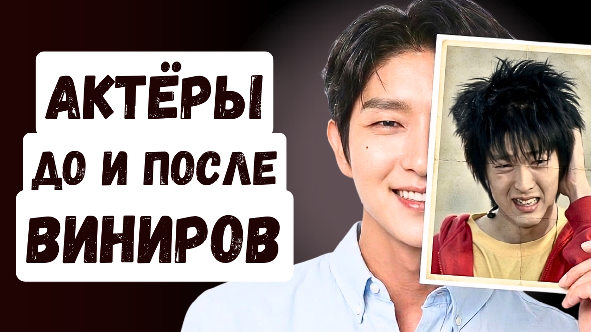 Удивительные преображения корейских актёров, но какую цену они заплатили за красивую улыбку