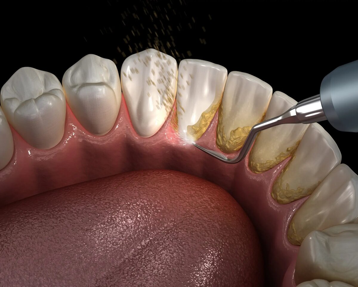    PeopleFirstDentistry.com