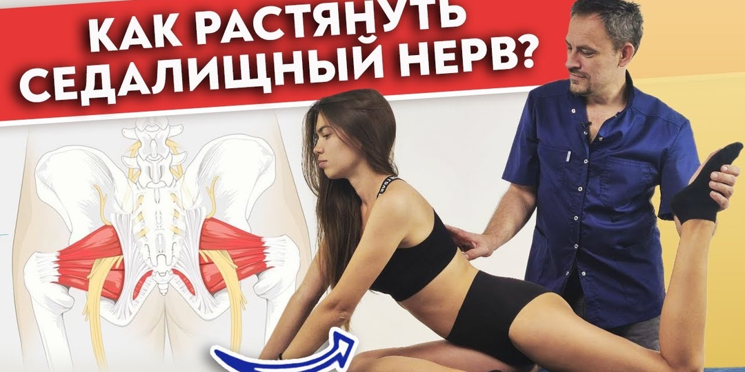 Защемило седалищный нерв — что делать? Как разблокировать седалищный нерв без боли?