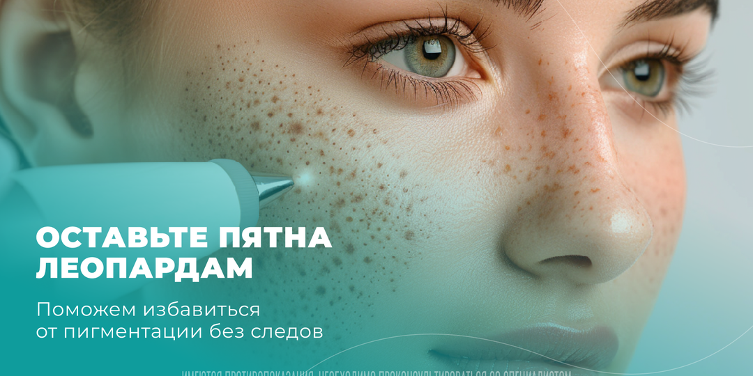 Пигментные пятна на коже: почему появляются и как лечить