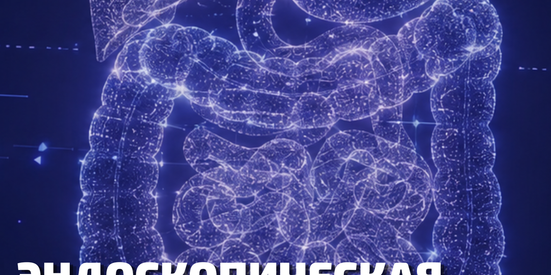 Эндоскопическая диссекция мышечного слоя пищевода: новый подход при глубоко инвазивной аденокарциноме Барретта