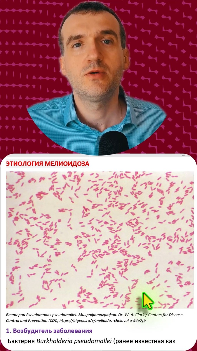 03 Какой микроб вызывает мелиоидоз. Свойства бактерии, вызывающей мелиоидоз. (Мелиоидоз - 03 Этиология)