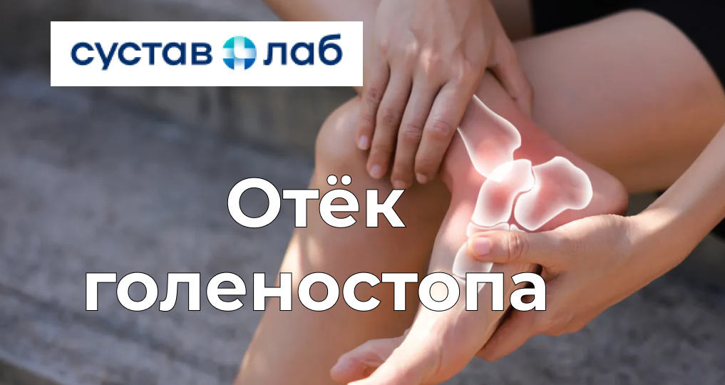 Отек голеностопа: когда стоит беспокоиться?