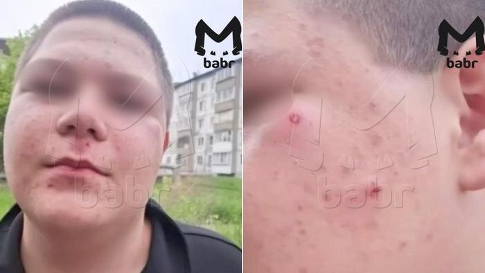 Мужчина открыл стрельбу из пневматики по подросткам после ссоры с соседями. Фото © Telegram / Babr Mash