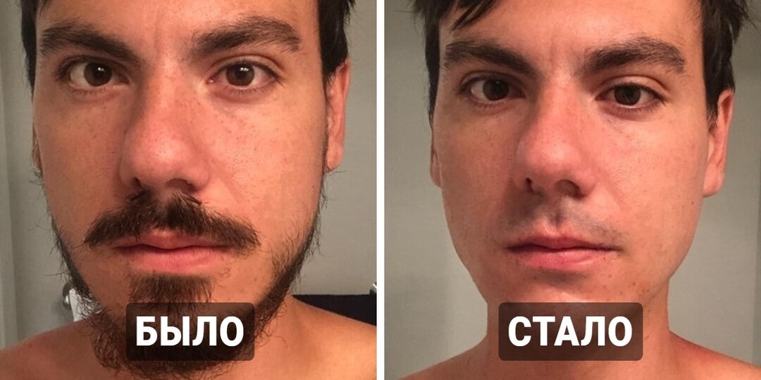 17 занимательных снимков из категории «было-стало», которые напомнят нам о том, что всё познаётся в сравнении