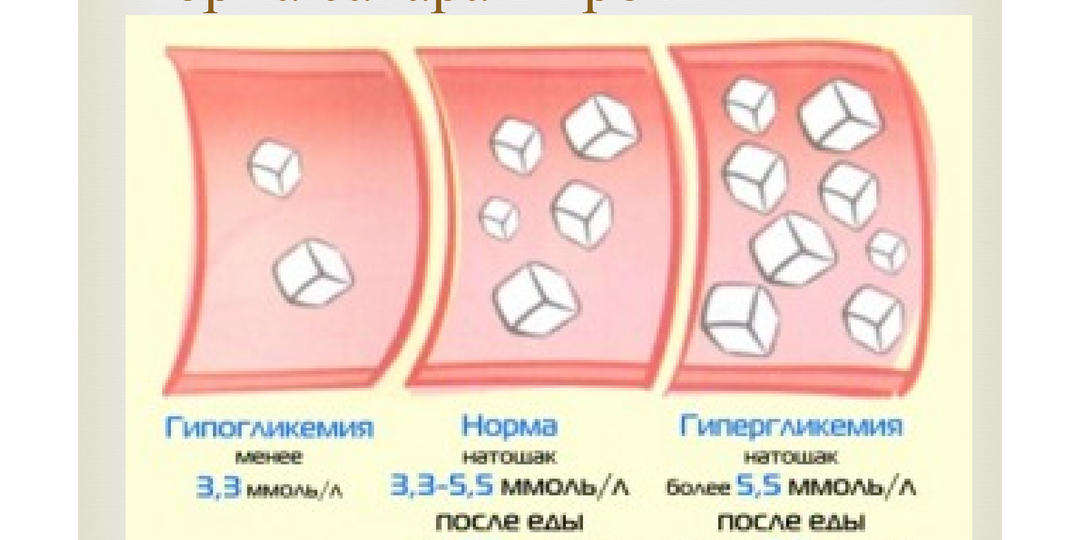 Гонка за нормой сахара в крови. Реальная история.