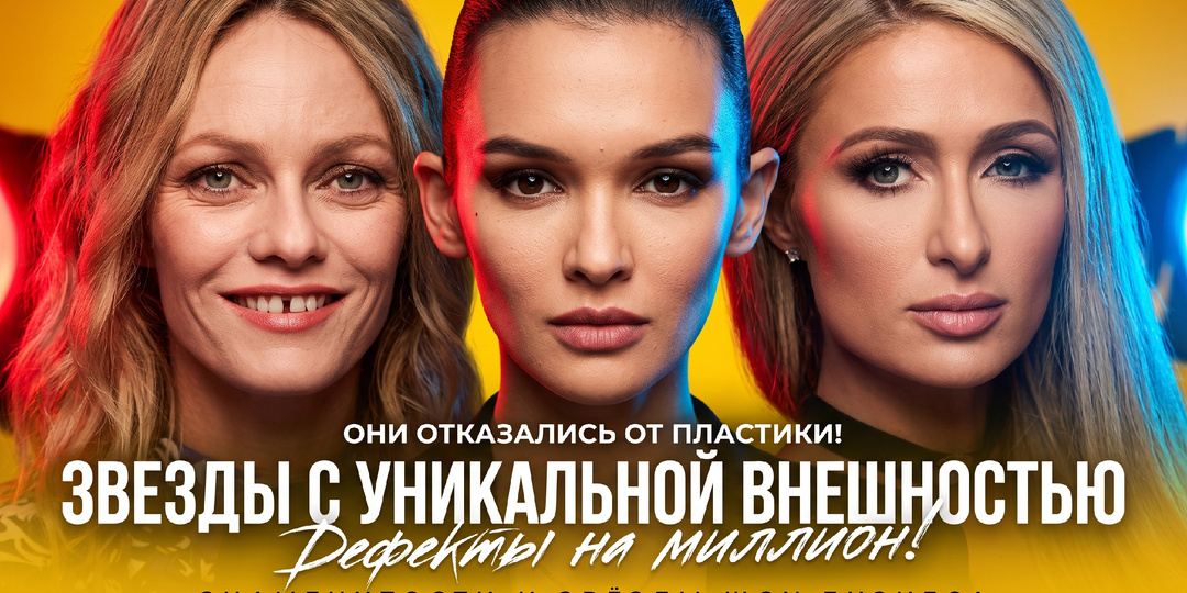Магия изюминки: знаменитости, которые превратили дефекты внешности в главный козырь