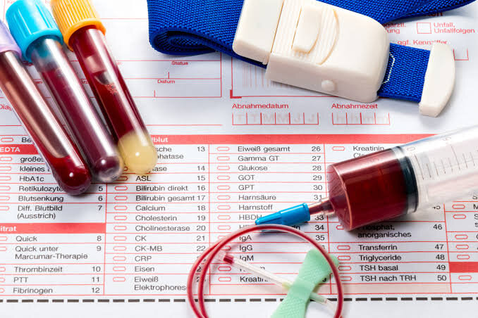 Общий анализ крови: как по цифрам узнать про анемию, инфекцию и риск тромбов