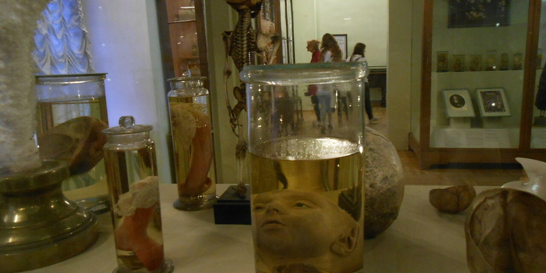 Голова Марии Гамильтон и Пётр Первый: история любви, казнь с лекцией и тайна подвалов Кунсткамеры