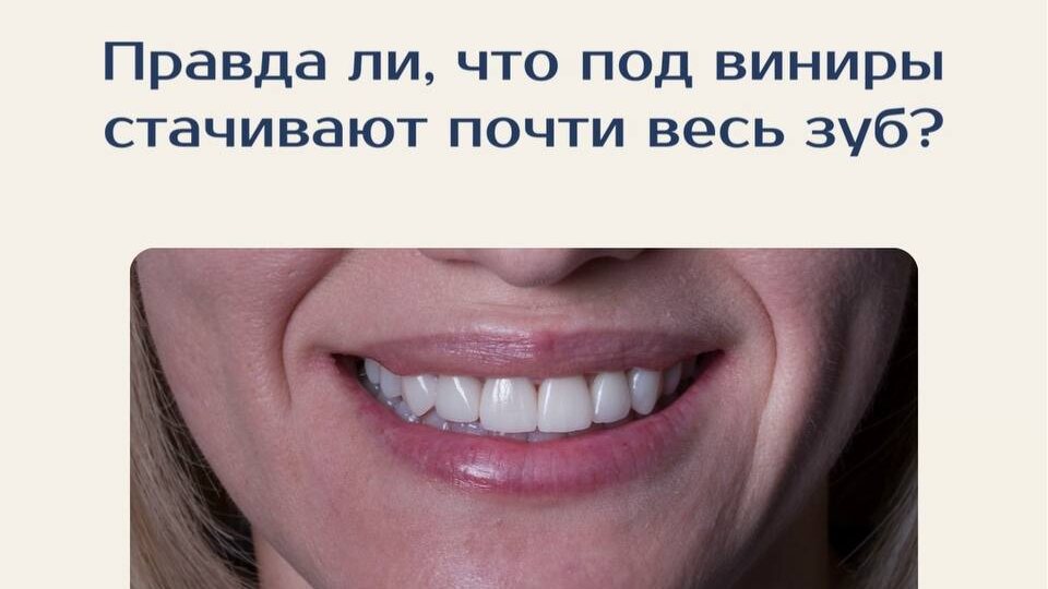 Идеальная улыбка с винирами — 39 000