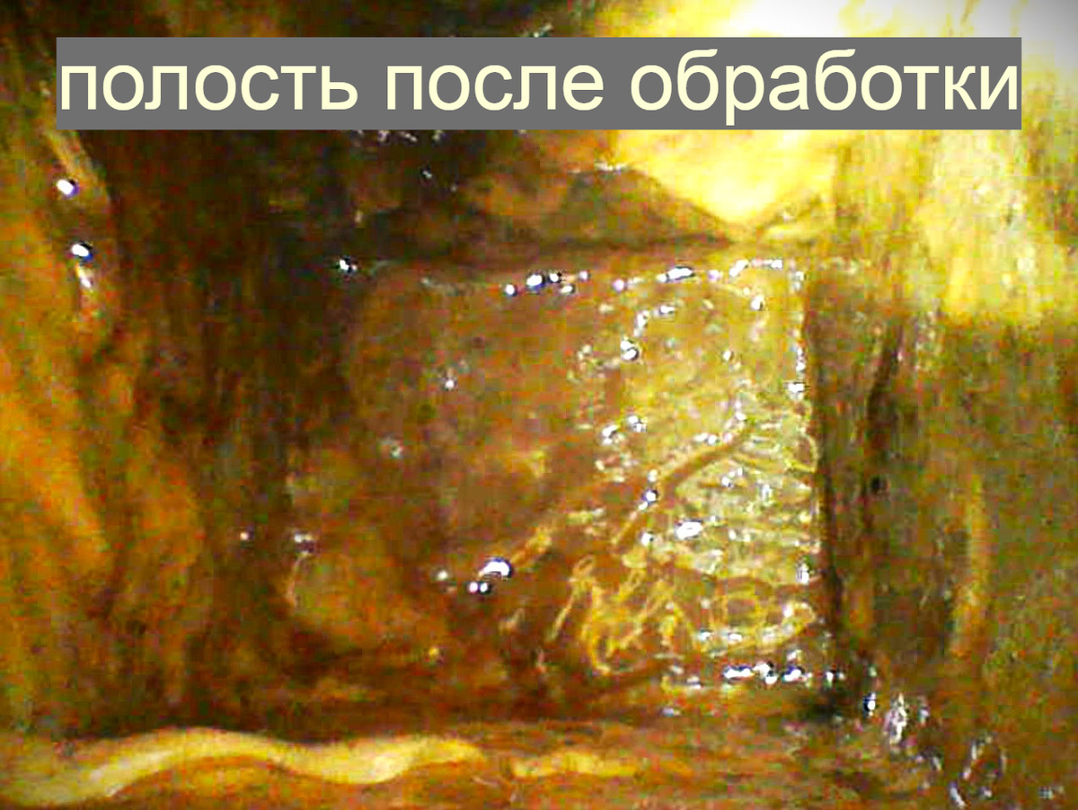 -18