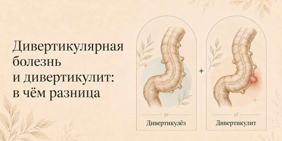Дивертикулёз и дивертикулит: в чём разница и когда нужен хирург