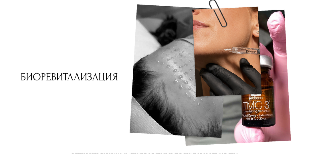 Одна процедура, которая заменяет гору дорогой косметики: рассказываем о биоревитализации