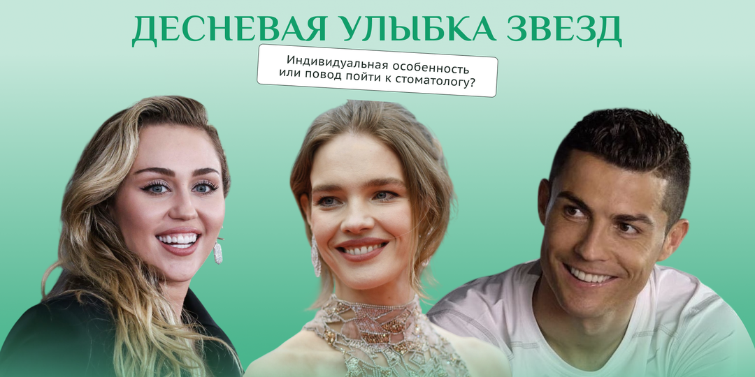 ЗУБЫ КАК У РОНАЛДУ ИЛИ ШЕЙК: ПОЧЕМУ ЗВЕЗДЫ ПРЯЧУТ ДЕСНЫ