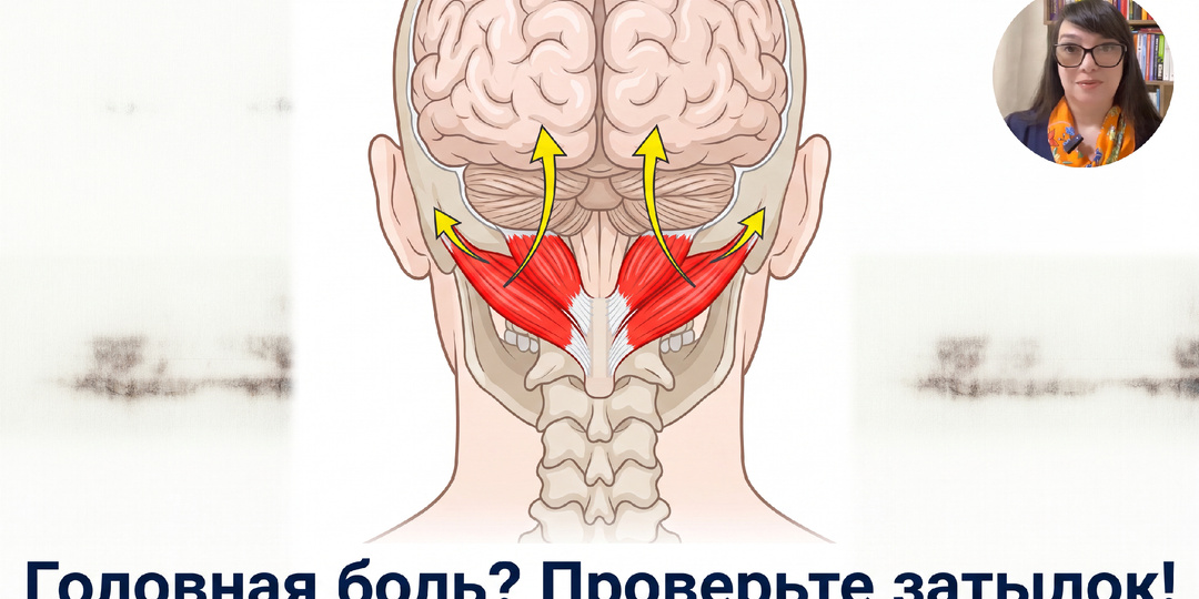 Головная боль от шейного зажима. Нейробиология и эффективные упражнения
