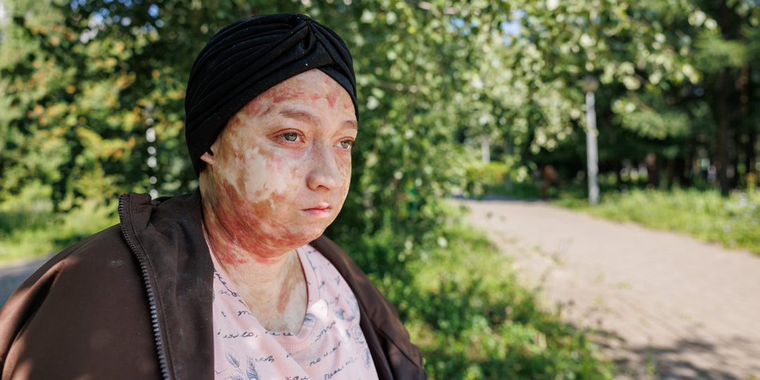 Донорские клетки атакуют клетки Регины. Ей срочно нужно лекарство