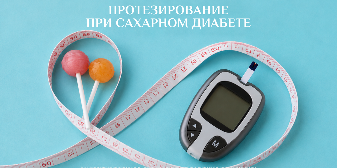 Протезирование зубов при сахарном диабете: как восстановить улыбку без осложнений и боли