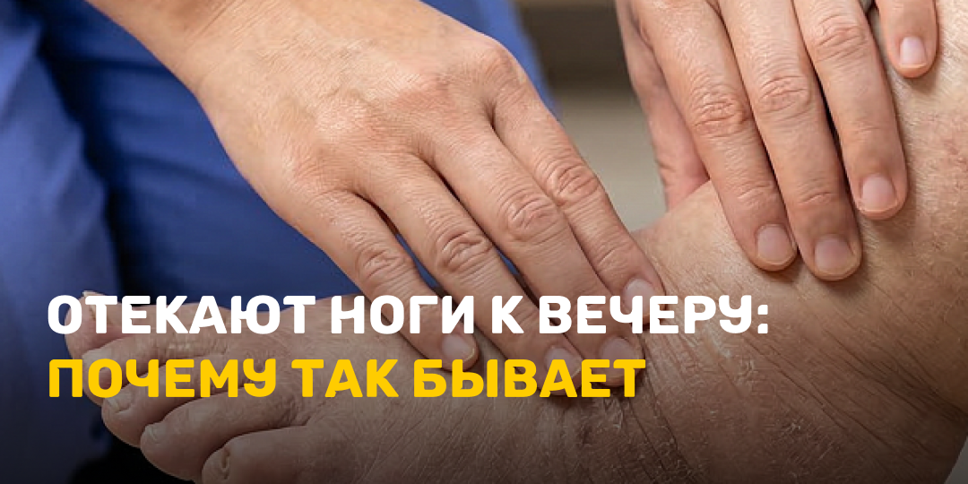 Отекают ноги к вечеру: почему так бывает