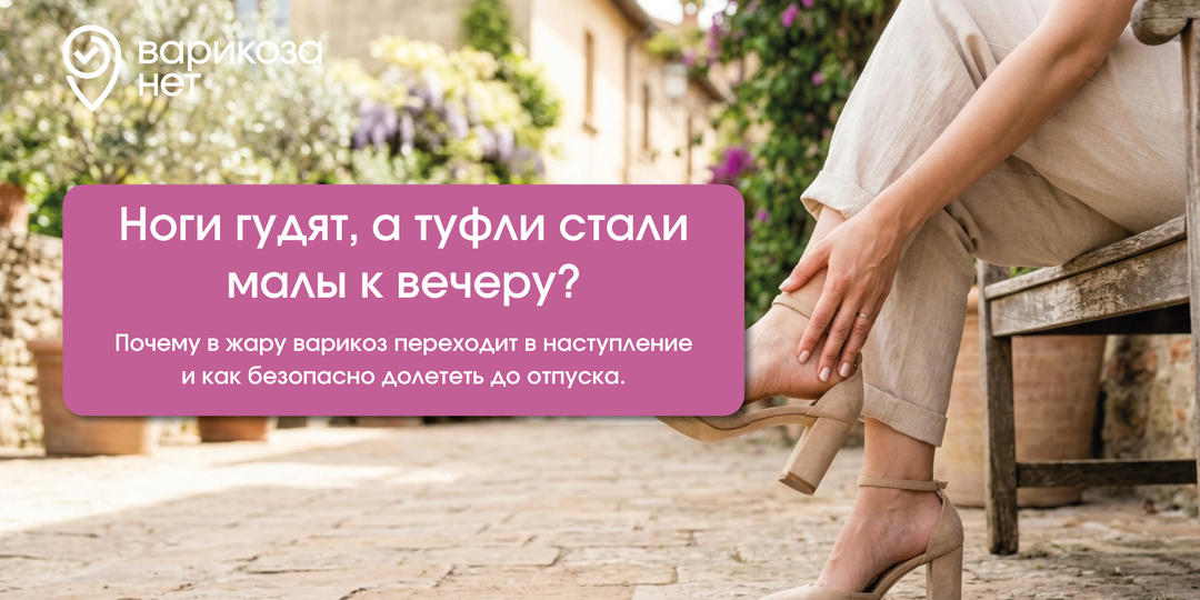 Ноги гудят, а туфли стали малы к вечеру? Почему в жару варикоз переходит в наступление и как безопасно долететь до отпуска