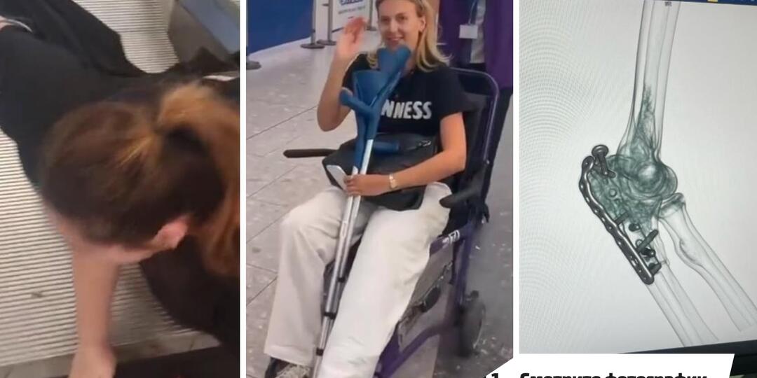 «Штаны смерти»: как модный хит из Zara отправил сотни женщин в больницу