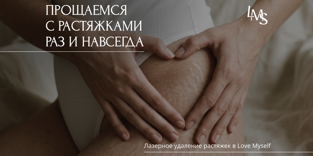 Как стереть растяжки и снова чувствовать себя уверенно