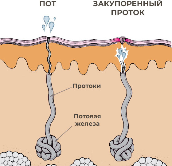 ЖЕЛЕЗЫ БУРГАВА