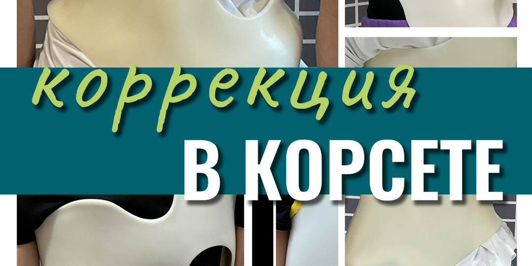 Коррекция в корсете Шено. Что ожидать?