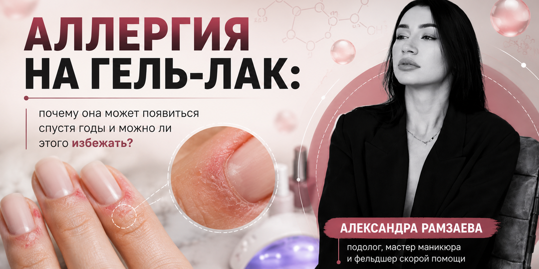 Аллергия на гель-лак: почему она может появиться спустя годы и можно ли этого избежать?