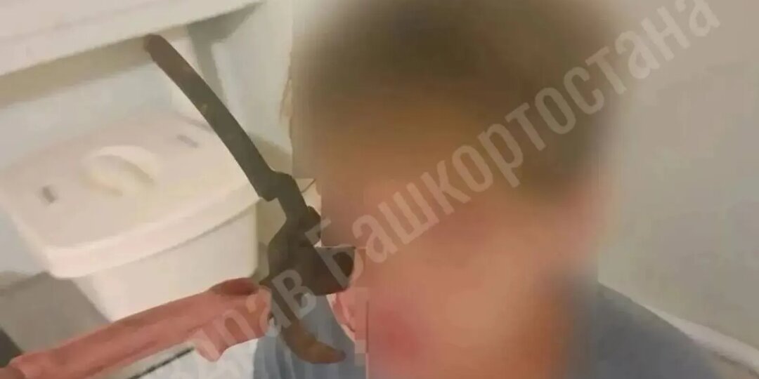 Лезвие секатора вонзилось в лицо ребёнку в Башкирии