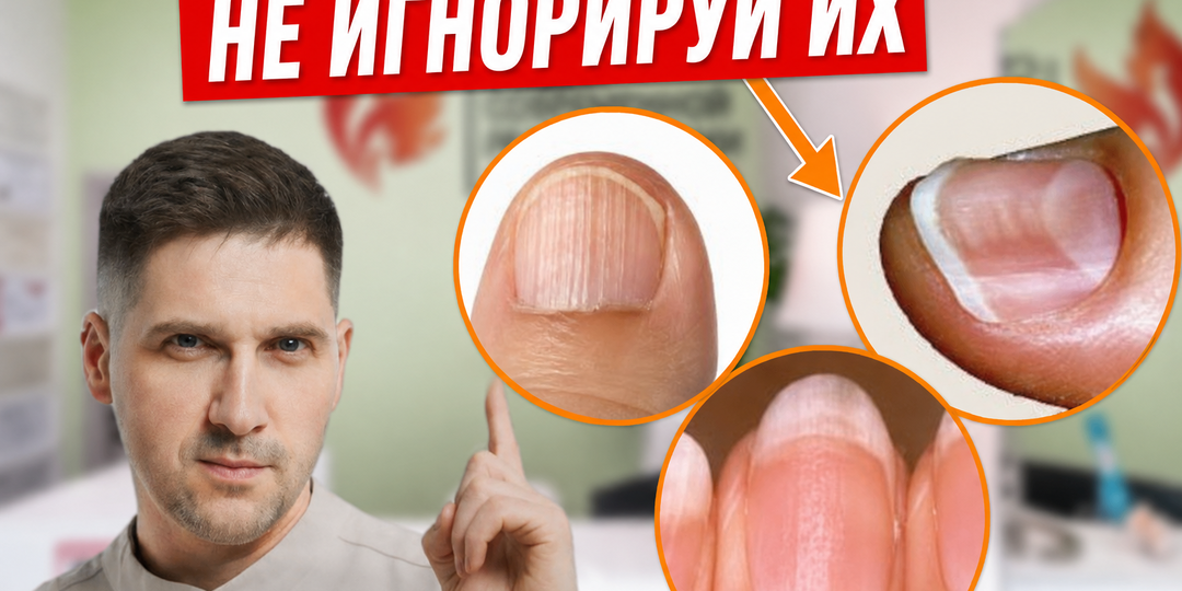 Что ногти говорят о вашем здоровье? От проблем со щитовидкой до болезней печени. Проверьте себя всего за минуту
