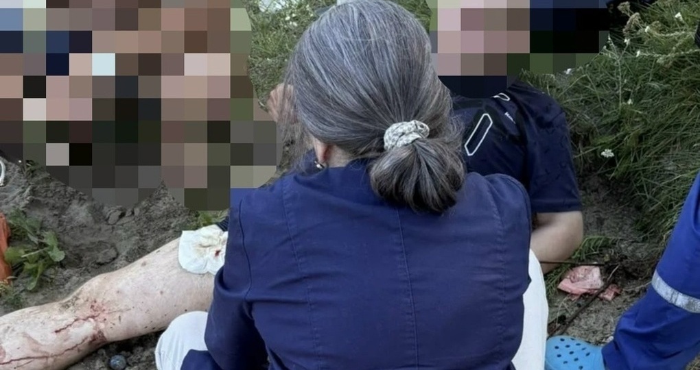 В Ярославле пьяный отдыхающий напоролся на шампур