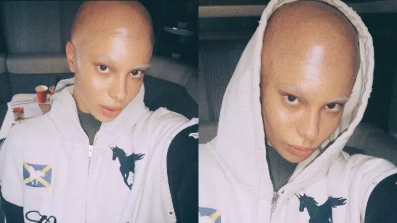 Почему 17-летняя дочь Сергея Жукова оказалась лысой и без бровей