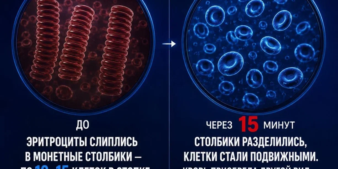 Что антигистамины делают с вами за 5 лет — и как с них слезть?