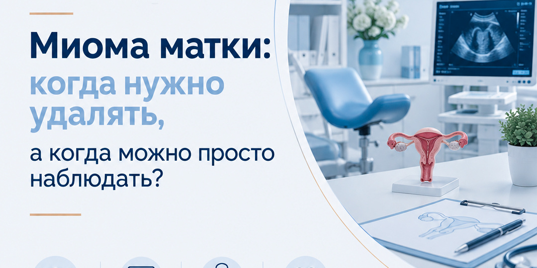 Миома матки: когда нужно удалять, а когда можно просто наблюдать?