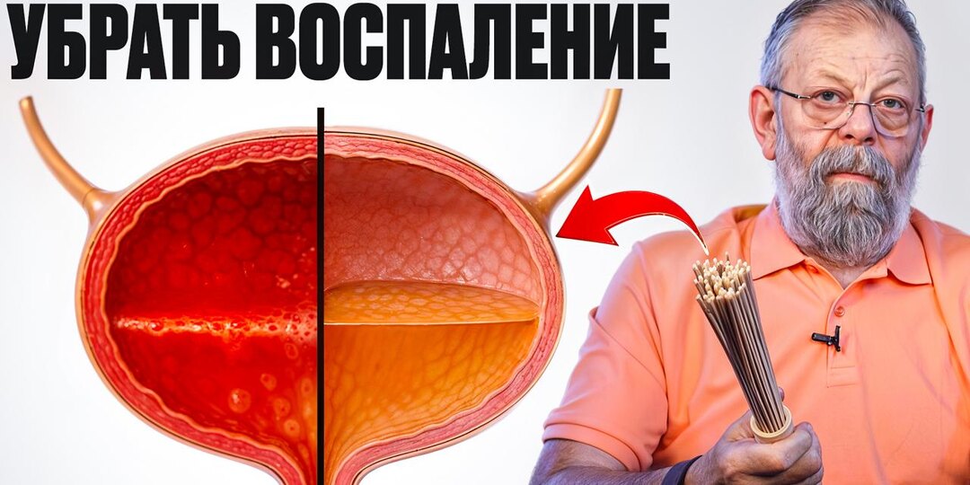 Уролог назвал напиток, который чаще других раздражает мочевой пузырь