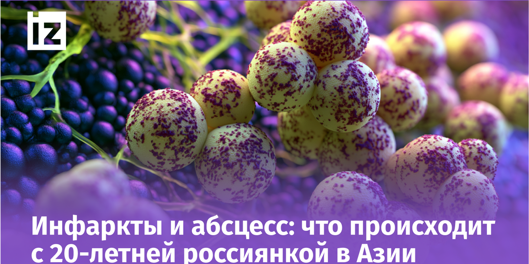 Царапина на теле чуть не стоила россиянке жизни: всё дело в опасной бактерии
