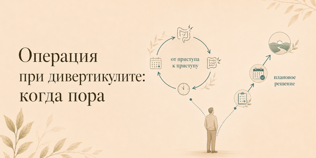 Операция при дивертикулите: кому она действительно нужна и что говорят исследования