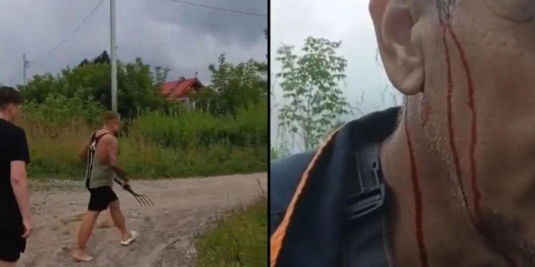 «Дорога раздора»: мужчина с вилами рассказал подробности кровавого конфликта между новосибирскими СНТ