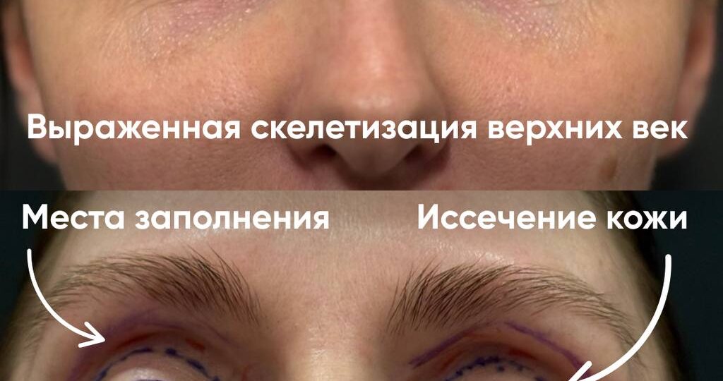 Что нельзя делать после пластической операции: 7 запретов и почему они важны