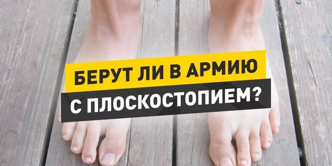 КАК ПОЛУЧИТЬ ВОЕННЫЙ БИЛЕТ ПО ПЛОСКОСТОПИЮ❓С КАКИМИ СЛОЖНОСТЯМИ ВОЗМОЖНО ВЫ СТОЛКНЕТЕСЬ В ВОЕНКОМАТЕ❗❗