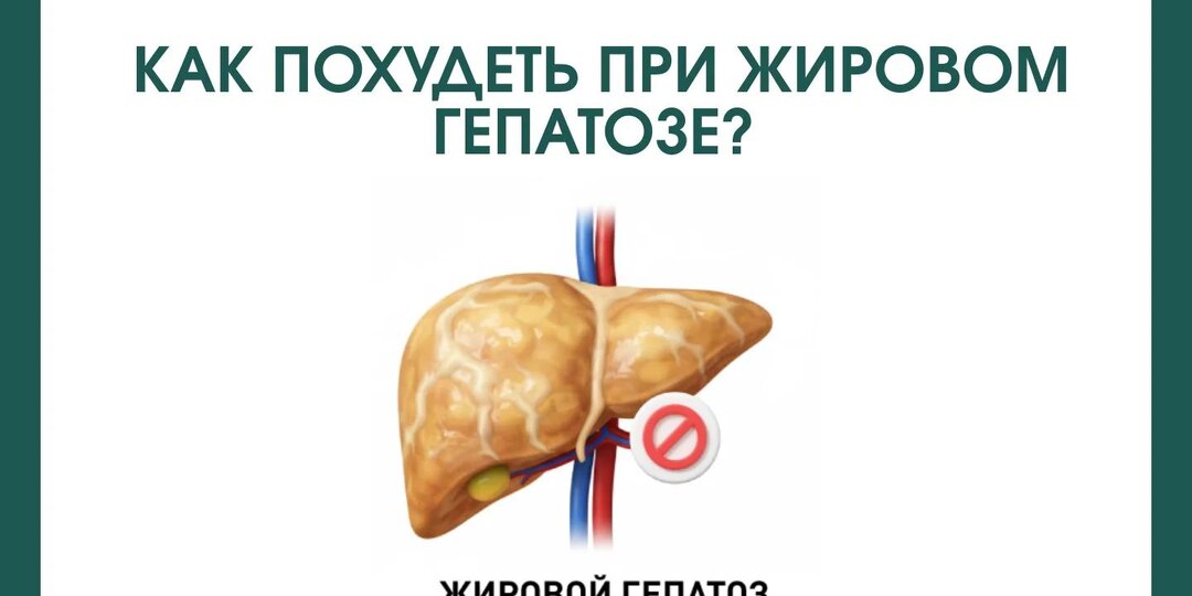Как похудеть при жировом гепатозе?