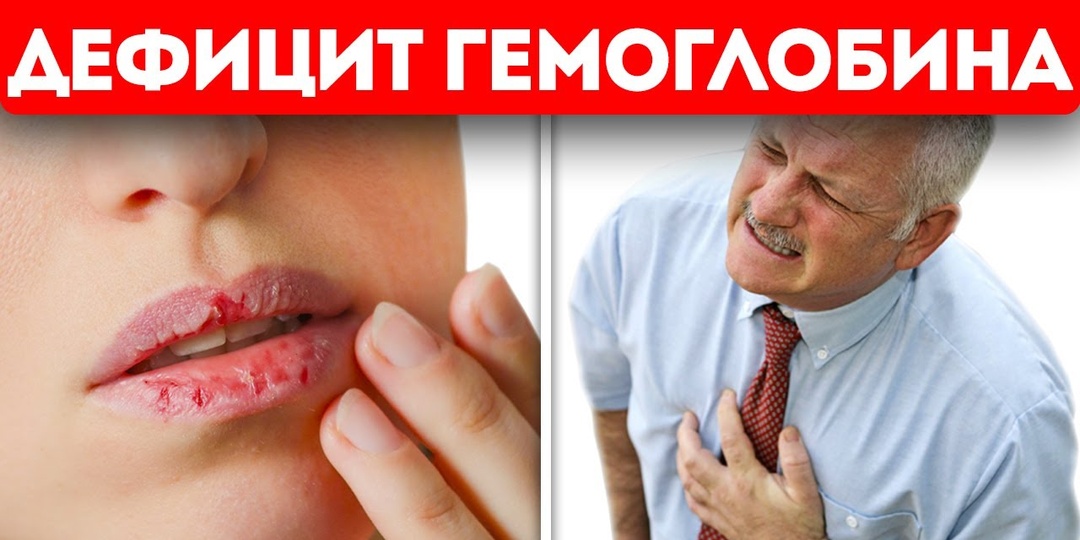 Новые рекомендации по анемии: почему одного гемоглобина иногда недостаточно