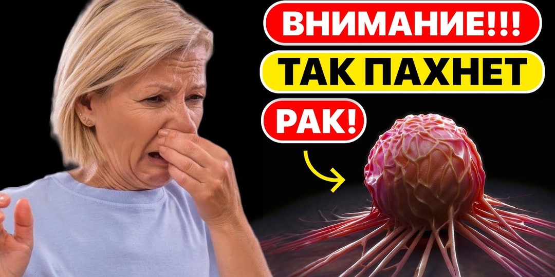 Предупреждающие знаки рака кишечника: какие изменения стула врачи советуют проверять