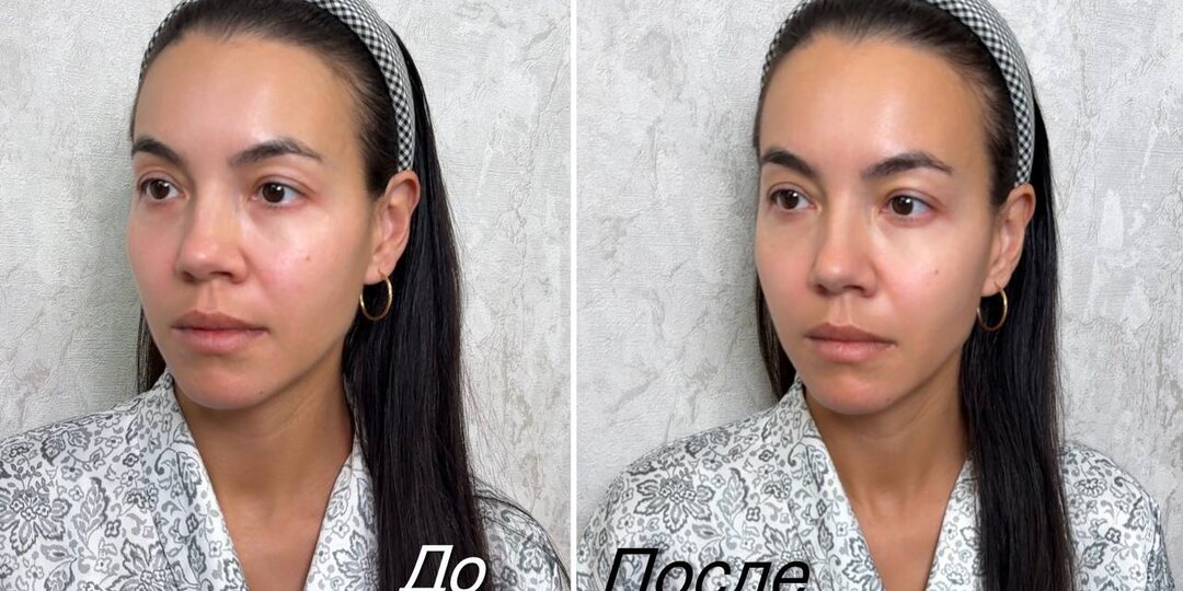 Модные способы из соцсетей или проверенные средства от отечности — что выбираем?