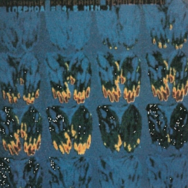 Рис. 2