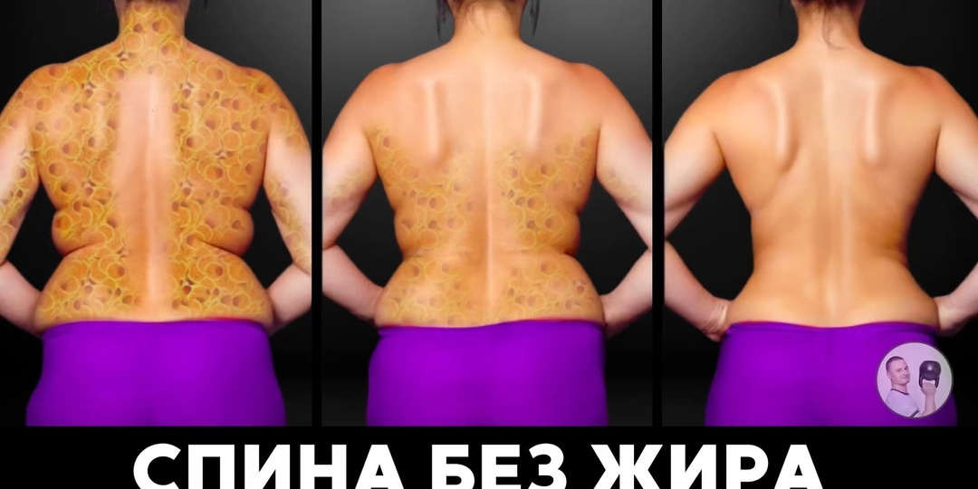 Жировые складки на спине сами отвалятся после этого!