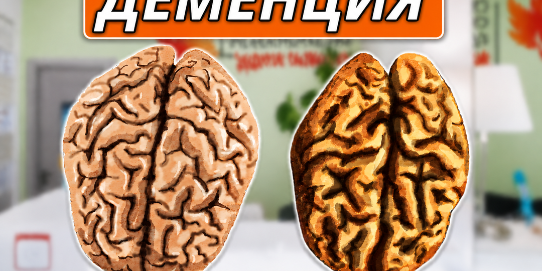 7 первых признаков деменции: что нельзя игнорировать после 50 лет. 5-минутная техника, которая реально спасает мозг от деменции