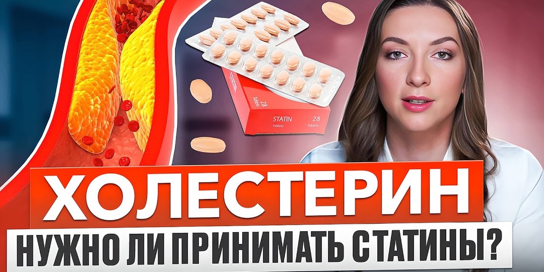 Что теперь рекомендуют врачи при высоком холестерине после 50 лет