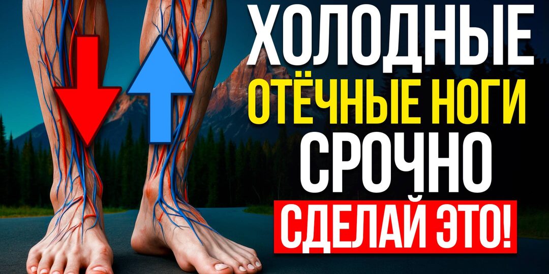 Если мерзнут ноги — это не просто плохое кровообращение