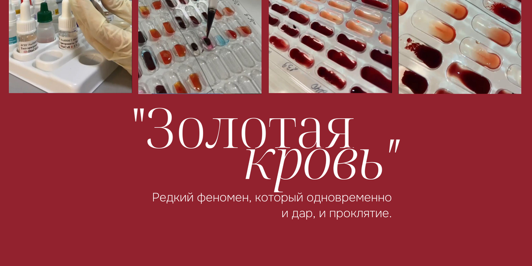 «Золотая кровь»: редкий феномен, который одновременно и дар, и проклятие